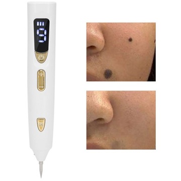 Удаление родинок Средство для удаления темных пятен