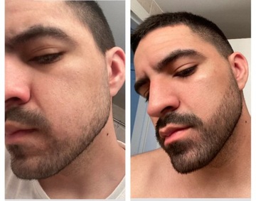 КАК СДЕЛАТЬ ВАЛИЦУ ДЛЯ БОРОДЫ ВАЛИКОМ ДЛЯ БОРОДЫ ВАЛИКОМ ДЛЯ БОРОДЫ