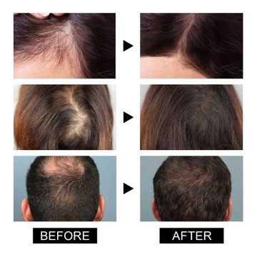 3 szt. Peeling oczyszczający skórę głowy korzeń