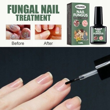 Nail Repair Essence Грибковая сыворотка 10 мл
