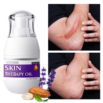 Eliminates Stretch Marks And Scars Repairs Aging