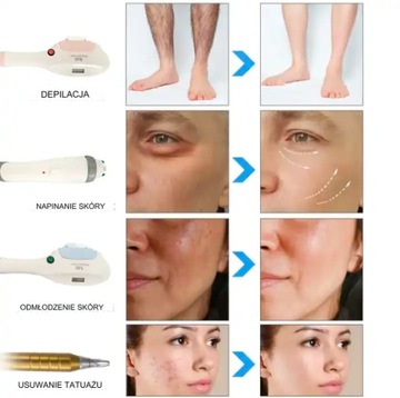Nd Yag Laser 4in1 IQPRO Удаление волос с татуировкой Электролиз OPT IPL
