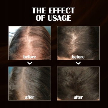 OUHOE Мощная сыворотка-спрей для роста волос