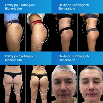 Массажный аппарат Zemits Bionexis Lite.