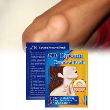 Lipoma Removal Medical Plaster