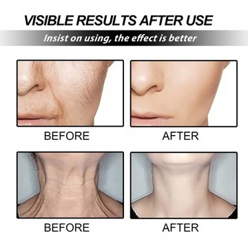 Krem Ujędrniający Twarzy Naprawa Wybielanie Skóry