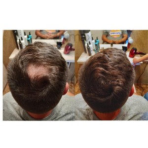 Kmax Microfibers для утолщения волос, 5 г, кератиновые волокна, натуральный, средний, коричневый