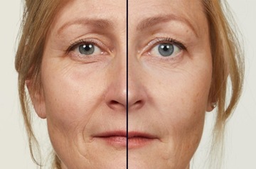 Loreal Revitalift Laser Сыворотка для лица против морщин с ретинолом