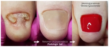 Podologic Гель для восстановления ногтей 30 мл Прозрачный