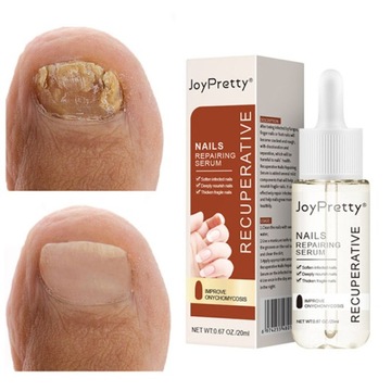 Грибок ногтей Strong Nail Repair Liquid