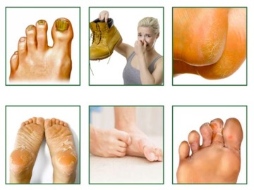 5X МАСКА ДЛЯ НОГ ОТшелушивающий носок, удаляющий омертвевшую кожу, 5 пар