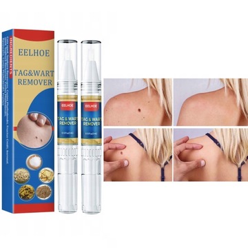 Средство для удаления бородавок и кожных меток