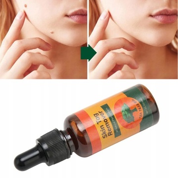 2x раствор для удаления бородавок на лице, 30 мл