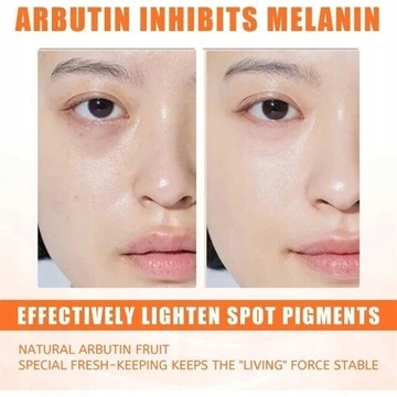 Отбеливающий гель-крем против веснушек