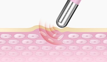 InFace Массажер для глаз для лица ОТ МОРЩИН черный