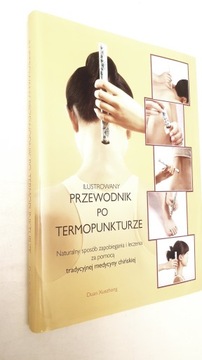 Ilustrowany przewodnik po termopunkturze Xuezhong
