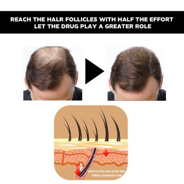 Polygonum multiflorum жидкость для ухода за волосами, против выпадения волос