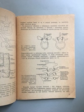Wady i bóle kręgosłupa - Żuk