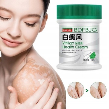 Krem na bielactwo psoralen gel-bielactwo nabyte