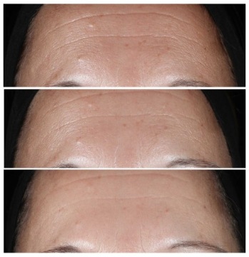 CLINIQUE Smart Clinical Repair Омолаживающая сыворотка