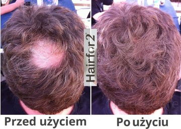 HairFor2 300мл Спрей из микрофибры для утолщения