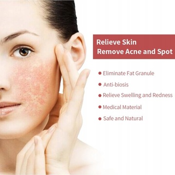 Мини-портативная лазерная ручка для удаления пятен от прыщей