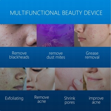 Электрический пылесос для чистки лица для удаления черных точек