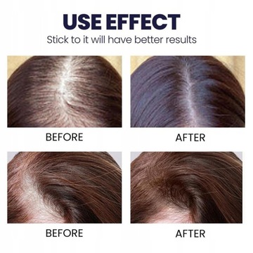 Спрей для роста волос, которые быстро растут против выпадения