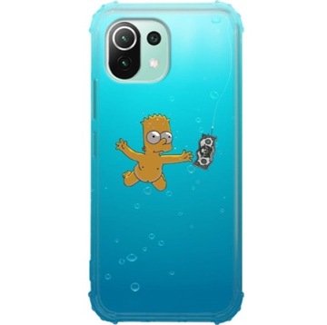 Etui Antishock Do XIAOMI MI 11 LITE 5G Modne Wzory