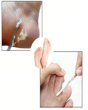 НОЖ СКРЕБОК ДЛЯ ПЯТОК ДЛЯ УДАЛЕНИЯ МОЛОДЫХ ДЛЯ МЕТАЛЛИЧЕСКОГО ПЕДИКЮРА