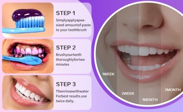 Красота зубов, удаление пятен, желтые зубы, чистка зубов, белые зубы