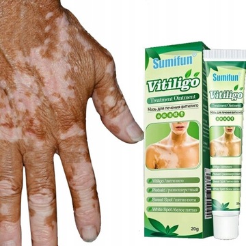 Vitiligo cream Krem na bielactwo 20g