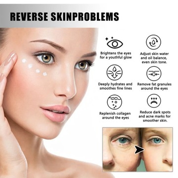 Крем для глаз, удаляющий морщины, уменьшает темные круги под глазами