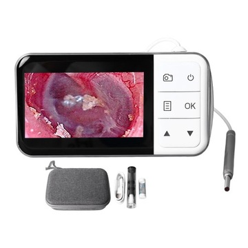 Цифровой отоскоп Визуальный удобный ушной вкладыш