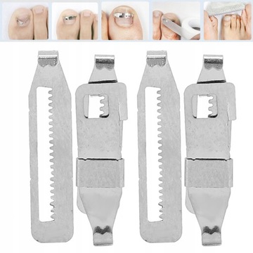 Пряжки от вросших ногтей SET Strips