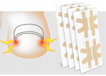 4 ЗАПЛАТКИ ДЛЯ ВРАСТНЫХ НОГТЕЙ, ПОЛОСКИ С ПРЯЖКАМИ