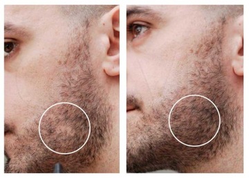 Оригинальный GLOVIS ROLLER 0,5 мм для утолщения бороды