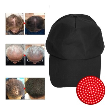 USB-шапка для роста волос, средство для контроля масла