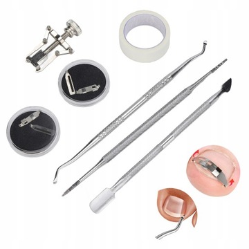 НАБОР КОРРЕКЦИОННЫХ КРОНШТЕЙНОВ ДЛЯ ВРАСТНЫХ НОГТЕЙ