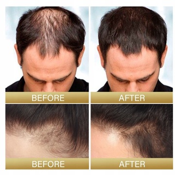 LJ Натуральная эссенция черного риса для роста волос