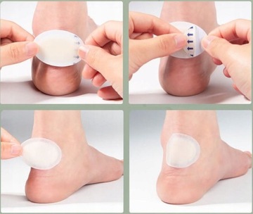 COMPEED СИЛИКОНОВЫЕ ПУЗЫРЬКИ 5 ШТ СРЕДНЕГО ЗАЖИВАНИЯ