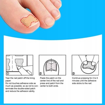 120 SZT PASKI PLASTRY ŁATKI NA WRASTAJĄCE PAZNOKCIE