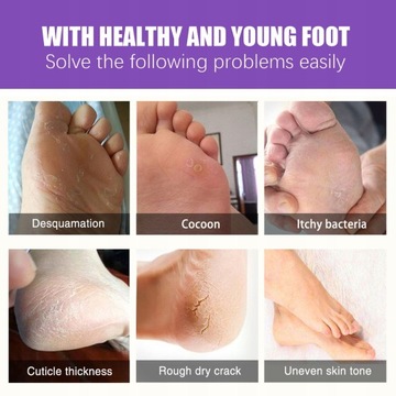 Imbirowa Maseczka Złuszczająca Do Stóp