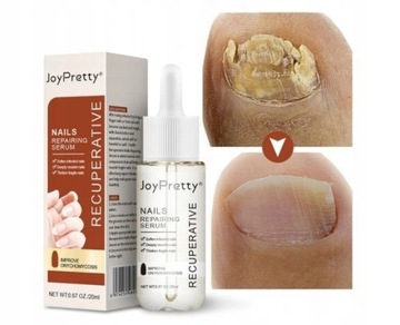 Грибок ногтей Strong Nail Repair Liquid