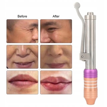 Ручка для инъекций гиалуроновой кислоты 7 см yi6eg