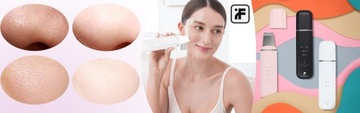 inFace КАВИТАЦИОННЫЙ ПИЛИНГ + щеточка для лица