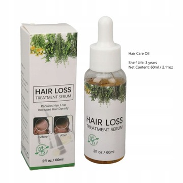 60 МЛ МАСЛО РОЗМАРИНА ДЛЯ ЛЕЧЕНИЯ РОСТА ВОЛОС