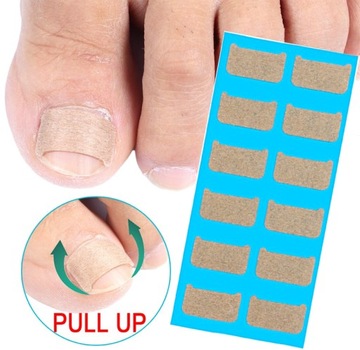 12 x PATCH STRIPES от вросших ногтей, патчи