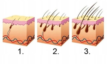 ВАЛИК ДЛЯ БОРОДЫ | утолщение | облысение | волосы на лице
