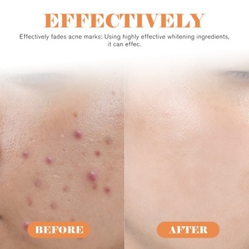 Наклейки от прыщей в форме звезды